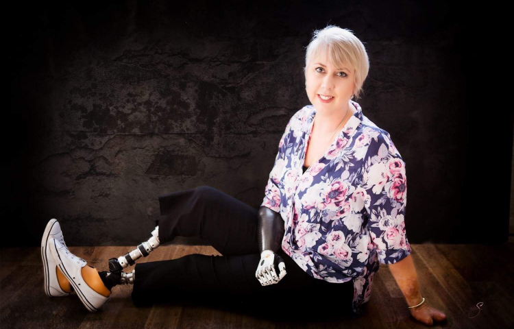 Havelock North's Korrin Barrett set for her longest walk on prosthetic legs